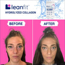 الكولاجين المتحلل من لينفيت